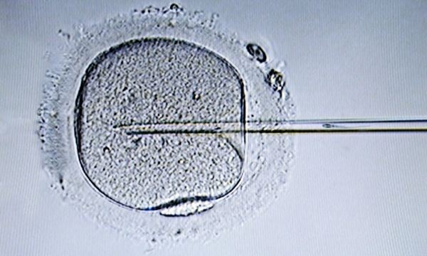 试管什么情况要养囊胚？囊胚陪养不成功的原因是什么问题？